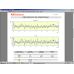 Surftest SJ-411 [mm] "R2µm; 0.75mN; X=25mm" | 178-580-11D